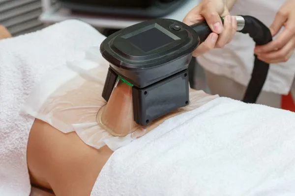 Image of person having fat freezing treatment to help weight gain Bagshot