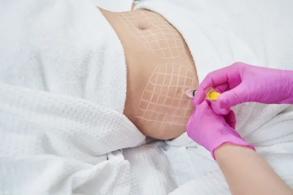 image of fat dissolving injections on love handles to help combat weight gain Bagshot
