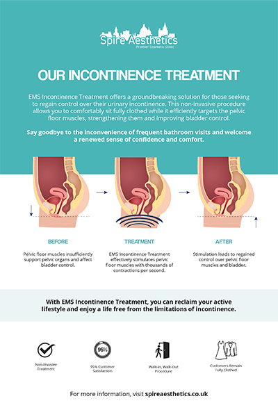 image to show how EMS treatment works for female urinary incontinence Bagshot