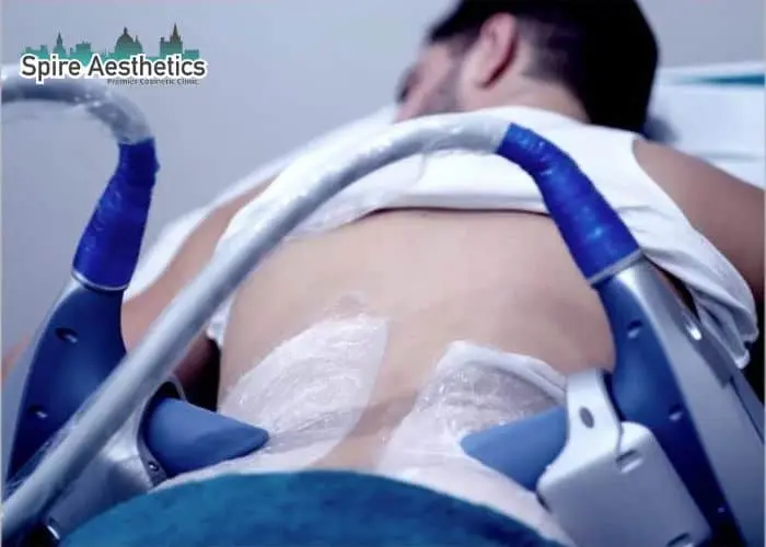 Man having fat freezing treatment done on love handles before a competitions Bagshot to create a sculpted look.