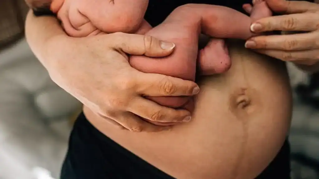 Why Is My Stomach Still Big After Pregnancy Bagshot?